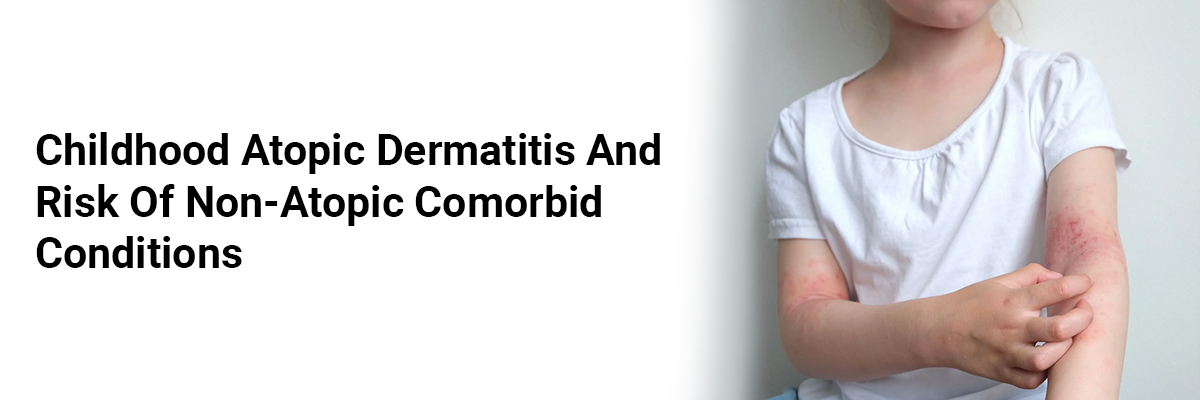 Childhood Atopic Dermatitis and Risk of Non-Atopic Comorbid Conditions